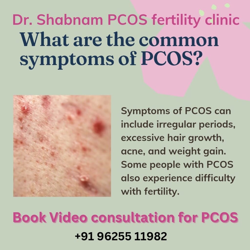 Polycystic Ovarian Syndrome (PCOS), PCOS Symptoms, PCOS Causes, PCOS Diagnosis, PCOS Treatment, PCOS and Infertility, PCOS and Weight Gain, PCOS and Acne, PCOS and Hirsutism, PCOS and Irregular Periods, PCOS and Insulin Resistance, PCOS and Metabolic Syndrome, PCOS and Lifestyle Changes, PCOS and Diet, PCOS and Exercise, PCOS and Mental Health, PCOS and Pregnancy, PCOS and Hormonal Imbalance, PCOS and Ovarian Cysts, PCOS and Menstrual Irregularities, PCOS and Androgens, PCOS and Subfertility, PCOS and Ovulation, PCOS and Reproductive Health, PCOS and Endocrine Disorders, PCOS and Women's Health, PCOS and Adolescents, PCOS and Young Women, PCOS and Long-term Health Risks, PCOS and Cardiovascular Health, PCOS and Diabetes, PCOS and Obesity, PCOS and Hair Loss, PCOS and Skin Problems, PCOS and Emotional Well-being, PCOS and Support Groups, PCOS and Medical Consultation, PCOS and Specialist Doctors, PCOS and Treatment Options, PCOS and Medication, PCOS and Surgery, PCOS and Alternative Therapies, PCOS and Research, PCOS and Clinical Trials, PCOS and Patient Education, PCOS and Awareness Campaigns, PCOS and Healthcare Services, PCOS and Online Consultations, PCOS and Telemedicine, PCOS and Fertility Treatments, PCOS and Assisted Reproductive Technology, PCOS and In Vitro Fertilization (IVF), PCOS and Hormone Therapy, PCOS and Birth Control Pills, PCOS and Metformin, PCOS and Clomiphene Citrate, PCOS and Letrozole, PCOS and Gonadotropins, PCOS and Laparoscopic Ovarian Drilling, PCOS and Weight Management, PCOS and Nutritional Counseling, PCOS and Exercise Programs, PCOS and Stress Management, PCOS and Sleep Apnea, PCOS and Thyroid Disorders, PCOS and Adrenal Disorders, PCOS and Genetic Factors, PCOS and Environmental Factors, PCOS and Lifestyle Factors, PCOS and Prevention, PCOS and Early Intervention, PCOS and Long-term Management, PCOS and Quality of Life, PCOS and Patient Support, PCOS and Healthcare Providers, PCOS and Medical Guidelines, PCOS and Best Practices, PCOS and Evidence-based Treatments, PCOS and Holistic Approaches, PCOS and Integrative Medicine, PCOS and Complementary Therapies, PCOS and Herbal Remedies, PCOS and Acupuncture, PCOS and Yoga, PCOS and Mindfulness, PCOS and Cognitive Behavioral Therapy, PCOS and Counseling, PCOS and Mental Health Support, PCOS and Depression, PCOS and Anxiety, PCOS and Emotional Distress, PCOS and Coping Strategies, PCOS and Self-care, PCOS and Body Image, PCOS and Self-esteem, PCOS and Sexual Health, PCOS and Intimacy, PCOS and Relationship Issues, PCOS and Family Planning, PCOS and Contraception, PCOS and Menopause, PCOS and Aging, PCOS and Bone Health, PCOS and Osteoporosis, PCOS and Heart Disease, PCOS and Stroke, PCOS and Cancer Risks, PCOS and Endometrial Cancer, PCOS and Breast Cancer, PCOS and Ovarian Cancer, PCOS and Regular Monitoring, PCOS and Health Screenings, PCOS and Blood Tests, PCOS and Ultrasound, PCOS and Imaging Studies, PCOS and Hormone Levels, PCOS and Blood Sugar Levels, PCOS and Cholesterol Levels, PCOS and Blood Pressure, PCOS and Liver Function, PCOS and Kidney Function, PCOS and Digestive Health, PCOS and Gut Microbiota, PCOS and Inflammation, PCOS and Oxidative Stress, PCOS and Antioxidants, PCOS and Vitamin D, PCOS and Omega-3 Fatty Acids, PCOS and Supplements, PCOS and Probiotics, PCOS and Herbal Supplements, PCOS and Nutraceuticals, PCOS and Functional Foods, PCOS and Dietary Fiber, PCOS and Low Glycemic Index Diet, PCOS and High Protein Diet, PCOS and Low Carb Diet, PCOS and Mediterranean Diet, PCOS and Plant-based Diet, PCOS and Gluten-free Diet, PCOS and Dairy-free Diet, PCOS and Elimination Diet, PCOS and Food Sensitivities, PCOS and Eating Disorders, PCOS and Binge Eating, PCOS and Emotional Eating, PCOS and Cravings, PCOS and Appetite Control, PCOS and Metabolism, PCOS and Energy Levels, PCOS and Fatigue, PCOS and Physical Activity, PCOS and Strength Training, PCOS and Aerobic Exercise, PCOS and Flexibility Exercises, PCOS and Pilates, PCOS and Dance Therapy, PCOS and Physical Therapy, PCOS and Rehabilitation, PCOS and Occupational Therapy, PCOS and Support Networks, PCOS and Community Resources, PCOS and Online Forums, PCOS and Social Media Groups, PCOS and Advocacy, PCOS and Policy Making, PCOS and Funding Opportunities, PCOS and Grants, PCOS and Scholarships, PCOS and Research Opportunities, PCOS and Academic Programs, PCOS and Workshops, PCOS and Conferences, PCOS and Seminars, PCOS and Webinars, PCOS and Continuing Education, PCOS and Professional Development